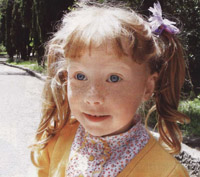 Что это за родинка?