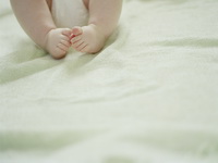 Врожденная косолапость