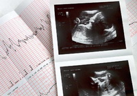 Заглянуть в будущее