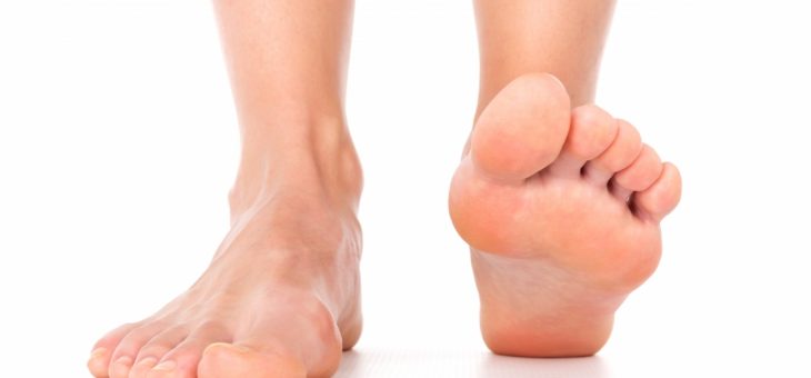 Плоскостопие. Признаки, виды, лечение